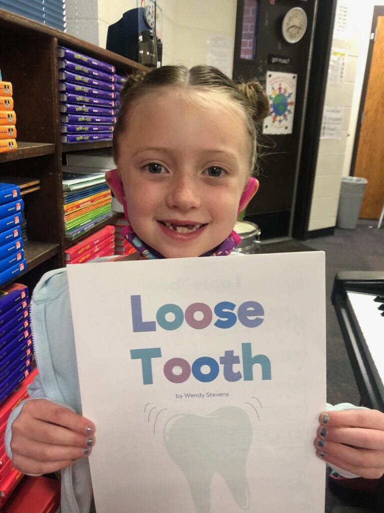 Loose Tooth | Modal Music from ComposeCreate.com